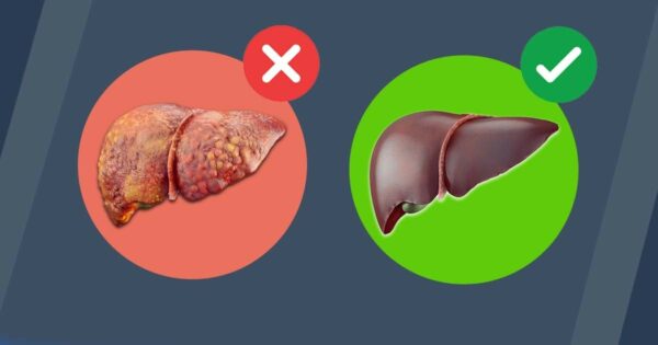 Liver detox – this is how to get rid of belly fat